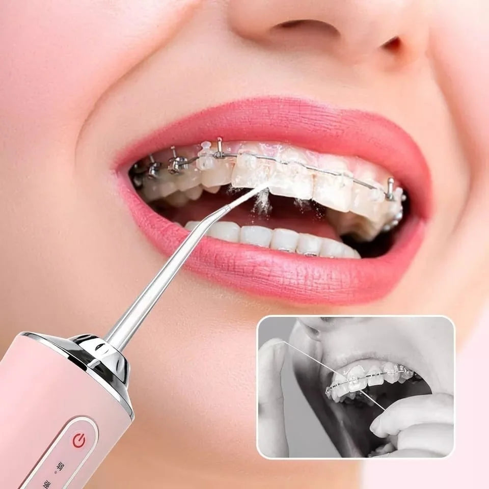 Irrigador Dental Oral Portátil Recarregável USB 220Ml Promoção Limpeza Bocal Jato Forte